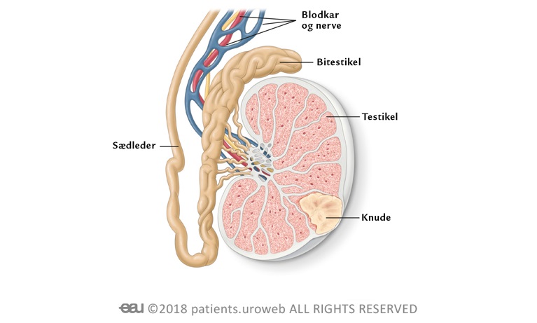 Illustration af knude i testikel
