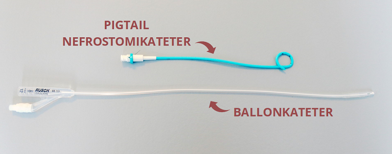 Pigtail nefrostomikateter og ballonkateter