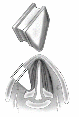 Billede 8