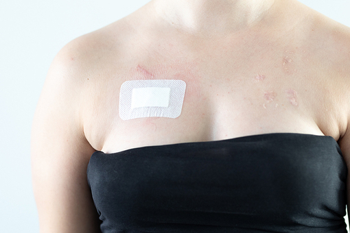 Foto af person med plaster over brystet