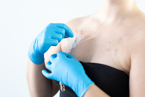 Foto af person, der fjerner plaster over brystet