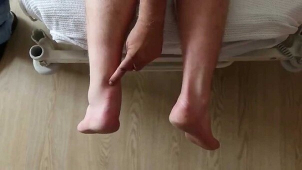 Foto af et par ben i liggende stilling set bagfra, hvor venstre ankel er ophovnet. Finger peger p&aring; akillessenens &oslash;verste h&aelig;ftning.