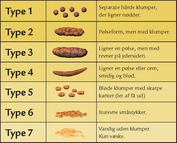 Bristolskalaen viser aff&oslash;ringskonsistens fordelt p&aring; 7 h&aring;rdhedsgrader. Type 1: separate h&aring;rde klumper, der ligner n&oslash;dder. Type 2: p&oslash;lseform, men med klumper. Type 3: ligner en p&oslash;lse, men med revner p&aring; ydersiden. Type 4: ligner en p&oslash;lse eller slange, bl&oslash;d og smidig. Type 5: bl&oslash;de klumper med skarpe kanter - let at f&aring; ud. Type 6: iturevne sm&aring;stykker. Type 7: vandig uden klumper - kun v&aelig;ske.