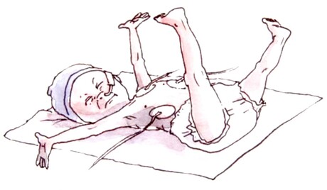 Illustration of a baby with spread fingers and toes plus spread arms and legs.