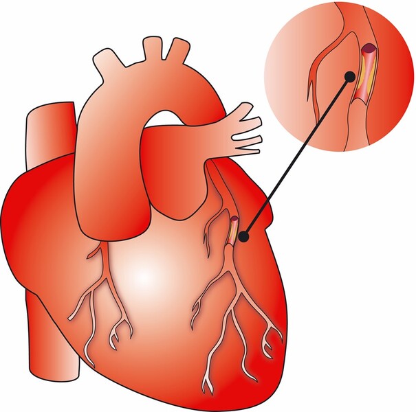 Beskrivelse findes i billedtekst.