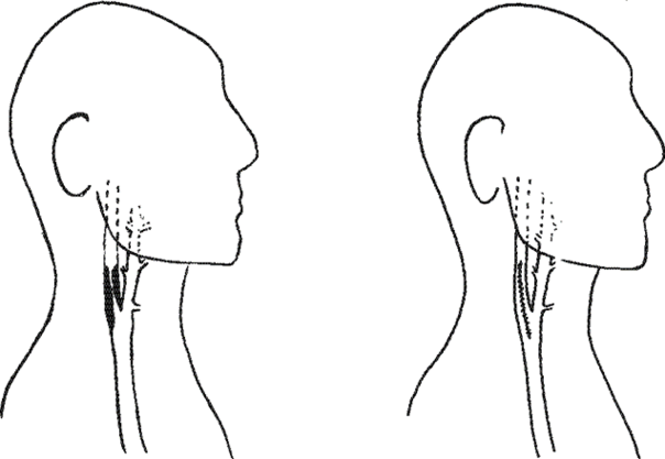 Beskrivelse findes i billedtekst.