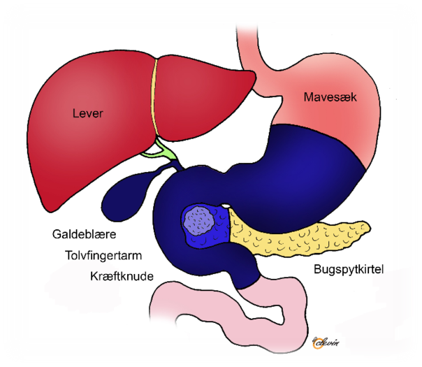 Mavens anatomi hvor placering af bugspytkirtel, kr&aelig;ftknude, maves&aelig;k, galdebl&aelig;re, tolvfingertarm og lever er afbilledet.