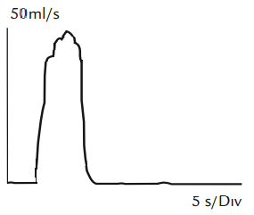 Diagram, enkeltst&aring;ende, t&aring;rnformet flowkurve