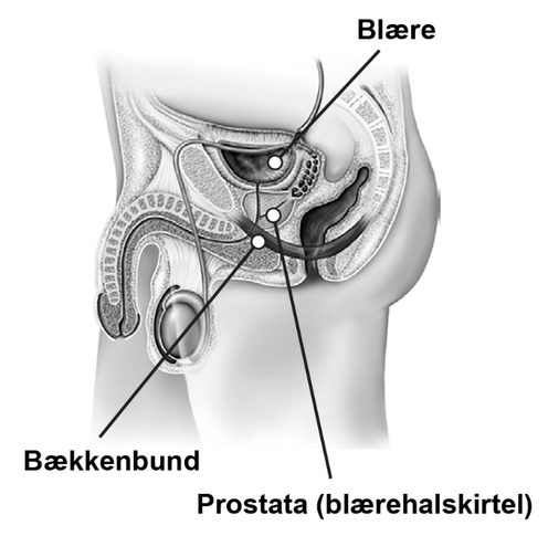 Billede 1