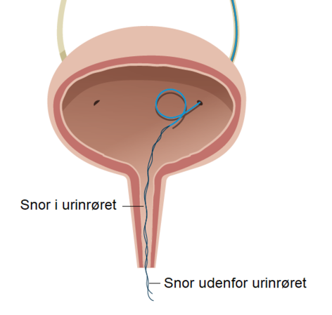 Snoren ses i bl&aelig;ren, urinr&oslash;ret og udenfor urinr&oslash;ret
