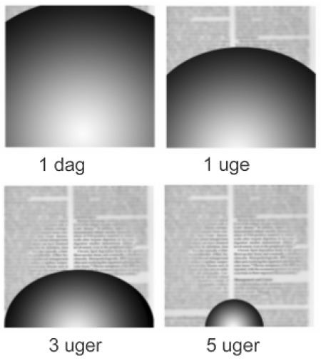 Illustration af, hvordan dit synsfelt vil udvikle sig i tiden efter operation