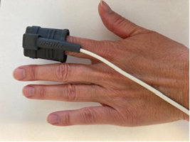 Iltm&aring;ler p&aring; pegefingeren