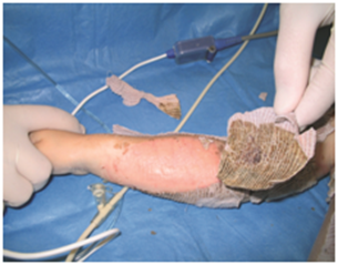 Beskrivelse findes i billedtekst.