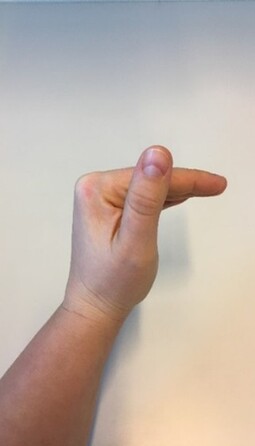 Billede 1