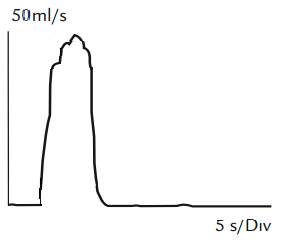 Diagram, enkeltstående, tårnformet flowkurve