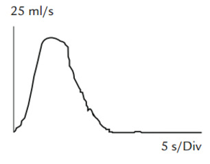 Diagram, klokkeformet flowkurve