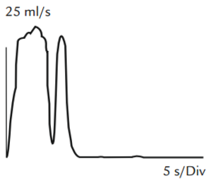 Diagram, stakatoformet flowkurve