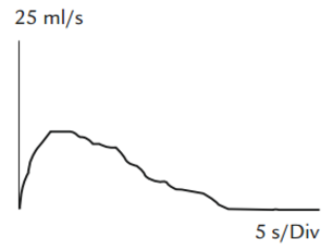 Diagram, flad, klokkeformet flowkurve