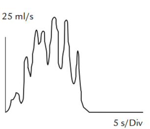 Diagram, takket flowkurve