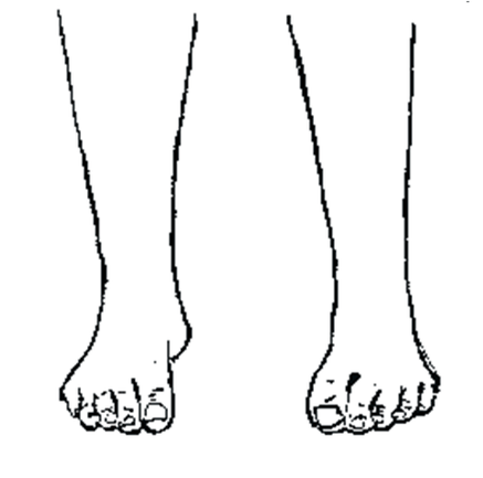 Billede 4