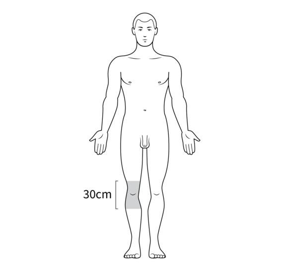 Illustration af menneske, hvor et område omkring det ene knæ er markeret med grå farve. Området angiver, hvor man skal barbere sig forud for operationen. Med tekst er der skrevet "30 cm" ud for det markerede område.