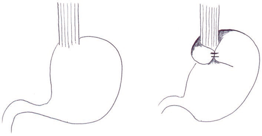 Billede 1