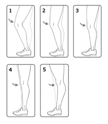 Serie af illustrationer,, der viser, hvor meget man skal kunne strække sit knæ 8 uger efter operation.