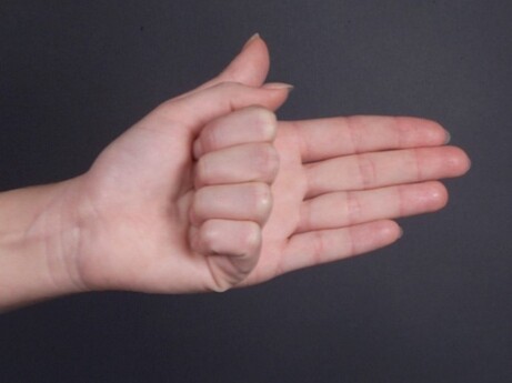 Et billede, der indeholder finger, person, tommelfinger, negl/s&oslash;m/n&aring;l

Automatisk genereret beskrivelse