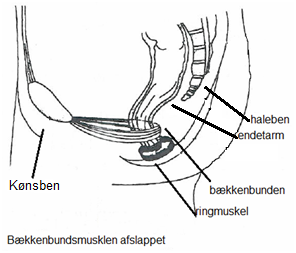 Billede 4